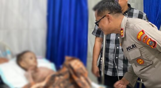 Di Penghujung Bulan Kemerdekaan RI Ke-78 , Kapolres Labusel AKBP Catur Sungkowo Bantu Balita Warga Torgamba Dengan Kondisi Yang Cukup Memprihatinkan
